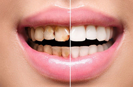 estetica dental vila-real