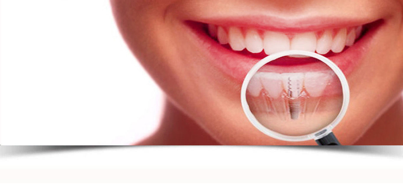 clinica dental vila-real