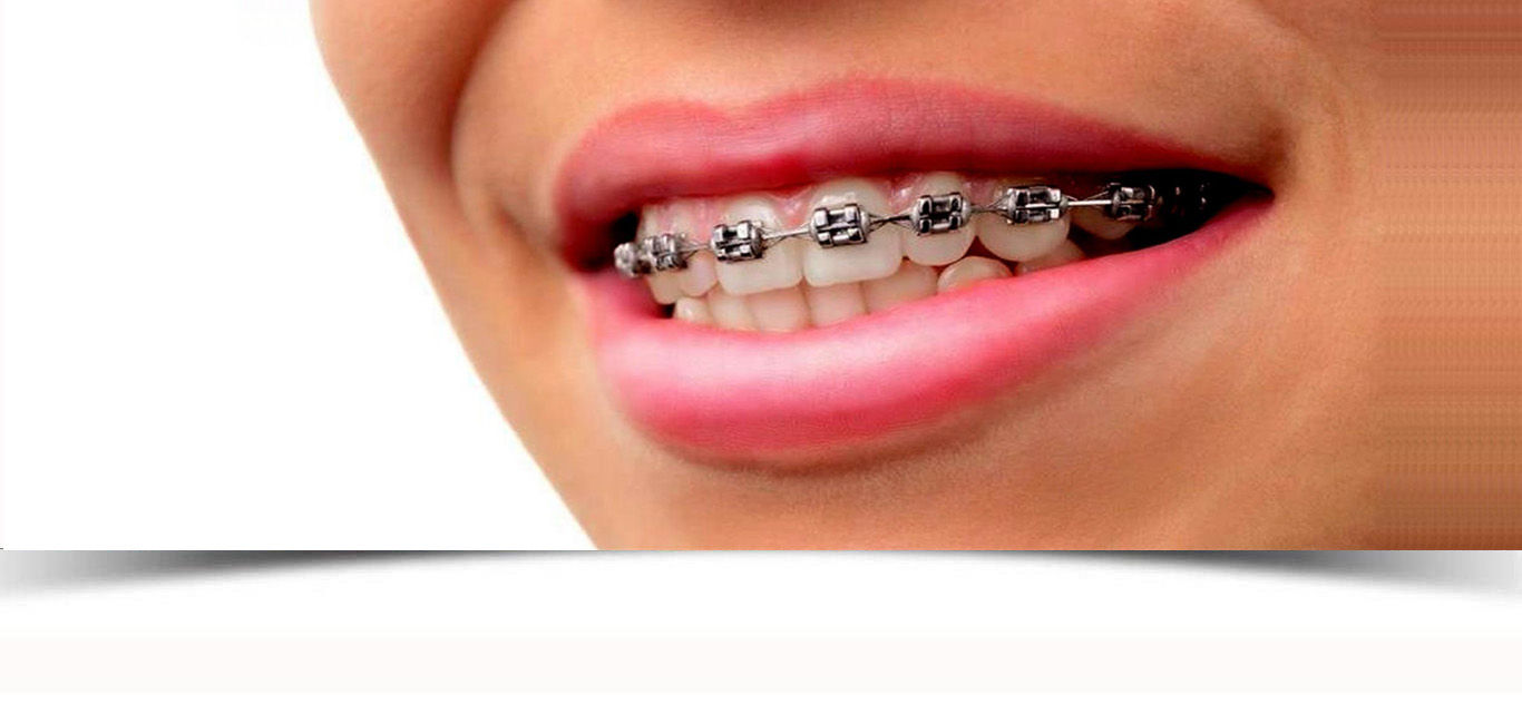 clinica dental en vila-real