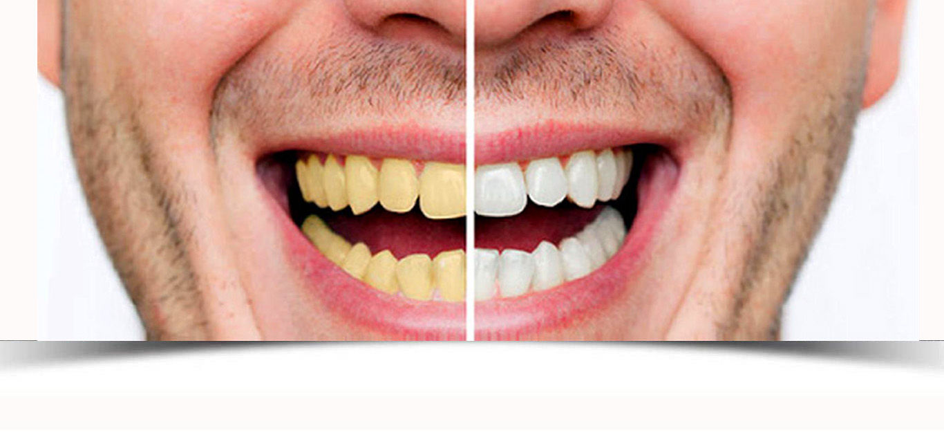 clinica dental vila-real